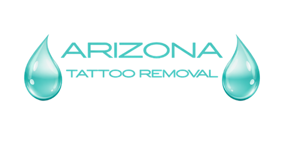 Arizona Tattoo Removal LLC